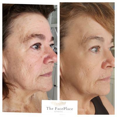 The FacePlace Esthetics