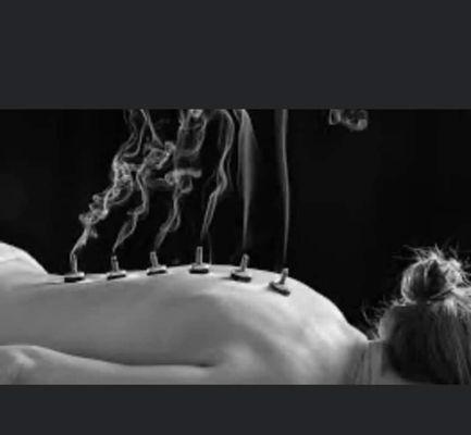 Moxibustion, provides a very relaxing affect with herbal smoke & warmth to increase circulation and promote good health
