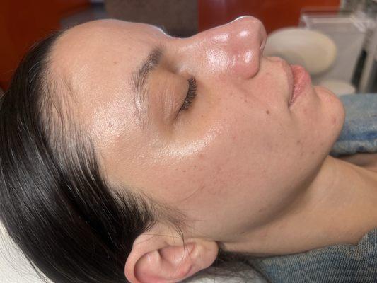 Who doesn't want smooth, glowing skin? Your facial is waiting on you at Bliss Beauty & Aesthetics!