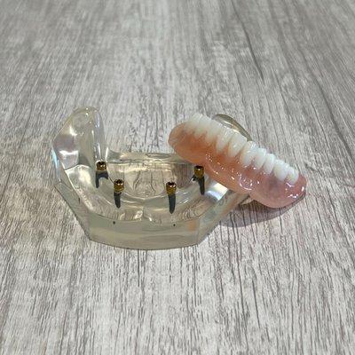 Prescott Dentures and Implants