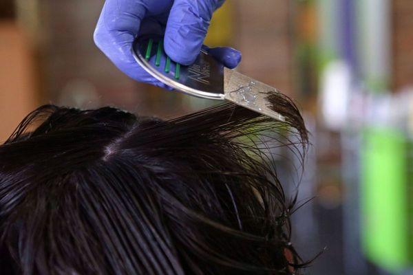Head Lice Removal Treatment Service