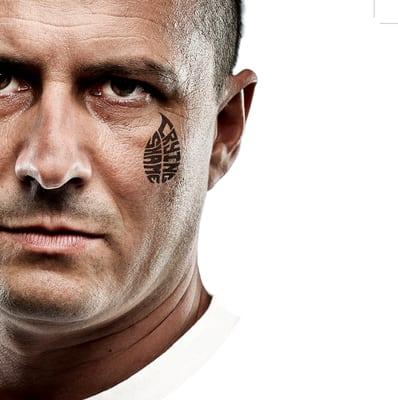 Mad Dog Tattoo Removal