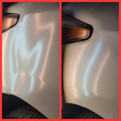 Front fender paintless dent repair