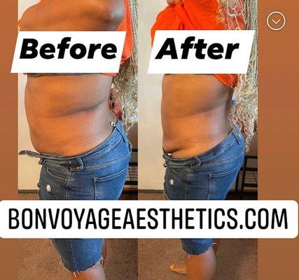 Bon Voyage Aesthetics & Body Sculpting