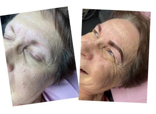 hybrid brow before and after