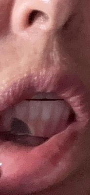 Dental Implant Center of Miami