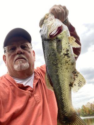 Nothing related to a root canal.