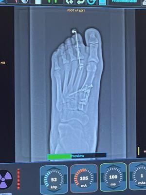 North Central Texas Foot & Ankle