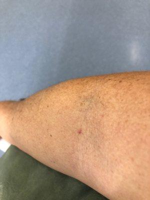 BioLife Plasma Services