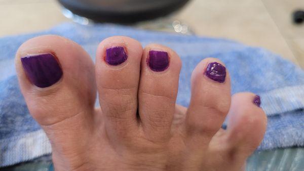Clump of polish, bleeding toe...