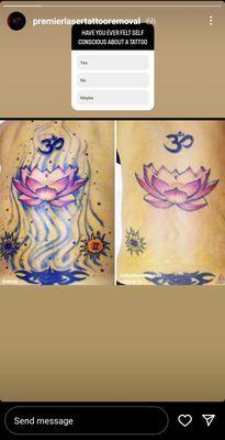 Before and after Tattoo removing lines and flower