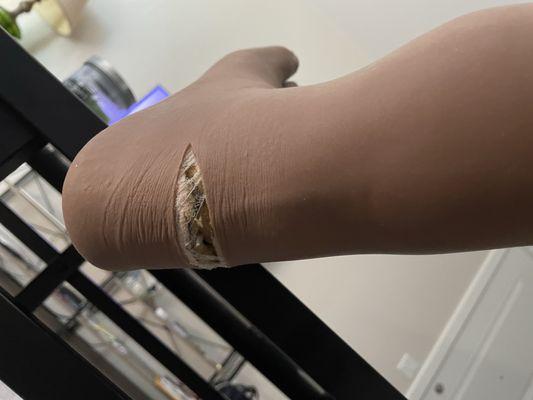 Orthotic Prosthetic Solutions