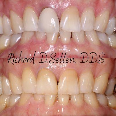 Richard D Sellen, DDS