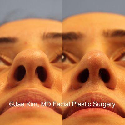 Jae Kim MD, Facial Plastic Surgery