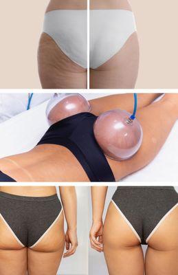 Unique Body Contouring & Aesthetics