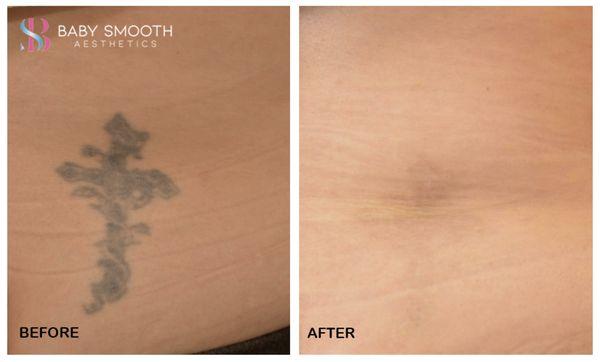 Baby Smooth Aesthetics