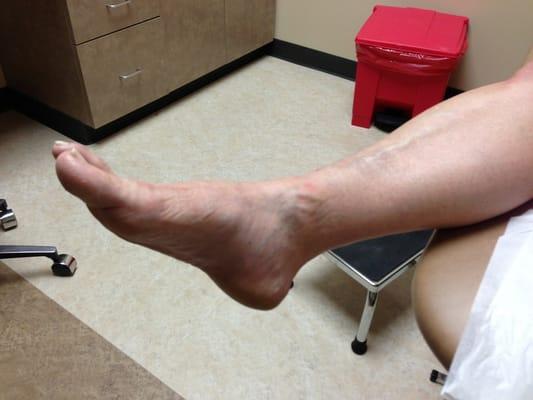 The broken ankle. Waiting for X-rays to determine if surgery is necessary or if they can just cast her up and send her home.