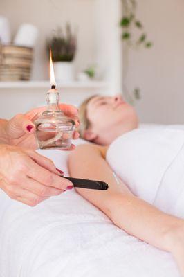 Moxa therapy is a powerful, soothing treatment for fertility support and pain relief. Experience deep warmth and healing that nurtures you!