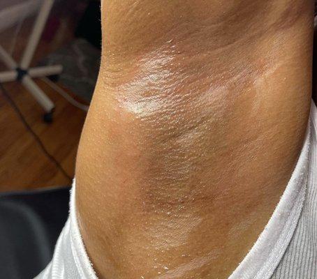 Underarm Wax