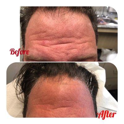 Make hair restoration