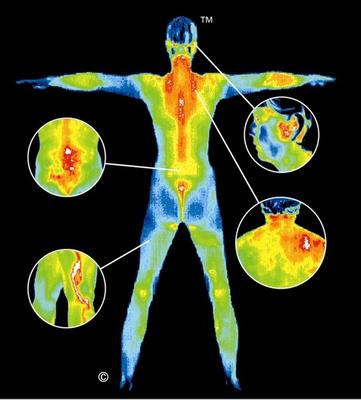 We offer Thermography. No radiation, no pain. Discover inflammation in your body!