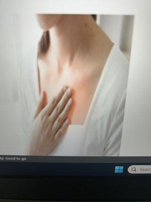 No more reflux to keep me up at night KL (Stony Point, NY)