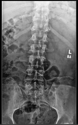 My spine. Looks good