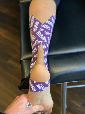 Rocktape for Achilles tendon strain rehab
