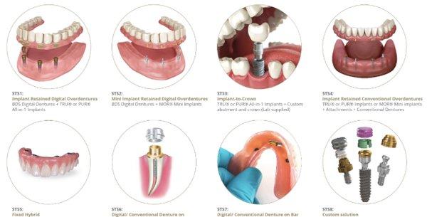 Friday only Specials 500 dollars off any new implant Denture up to 4 implants on Denture