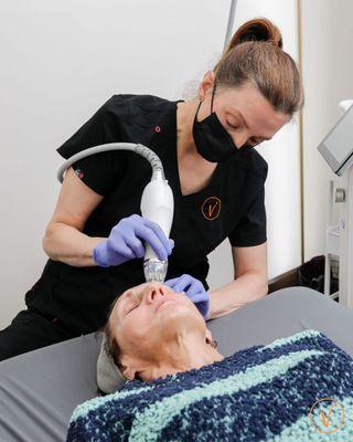 RF Microneedling - Med Spa in New Glarus, WI