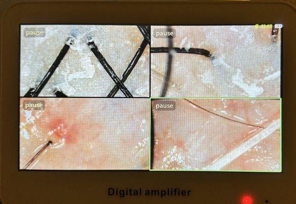 12/10/2025: Package D--Facial and Scalp Treatment.