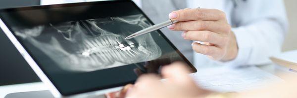 X-rays & exams at our Denver dental office are the perfect way to ensure your oral health is in tip-top shape!