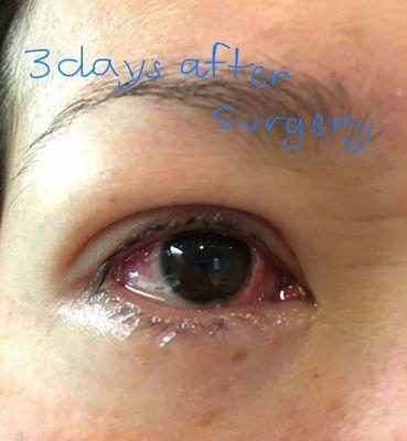 Franz Michel, MD - Ventura County Lasik