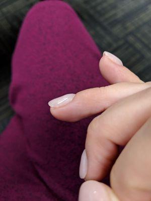 Chunky & uneven dip application