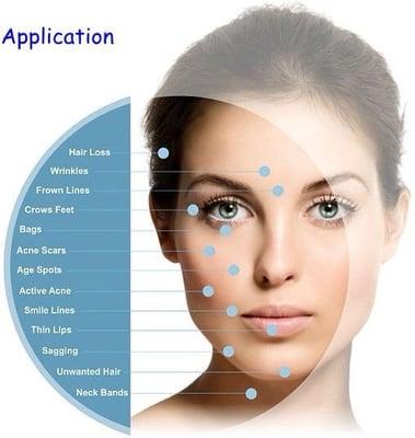 Micro needling: at $250 1st Visit.Closest to laser resurfacing without down time.  AMAZING RESULTS IN BUILDING COLLAGEN 1,2&3