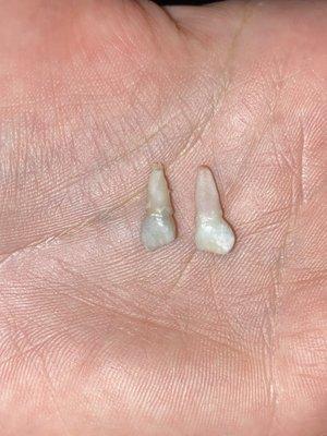 Newport Hills Pediatric Dentistry