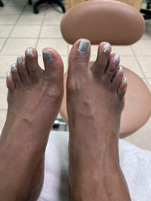 I should have taken a before and after. John got me RIGHT!! Note: the scar on my toe is from working out too much