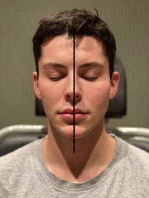 KYMA anti-aging center