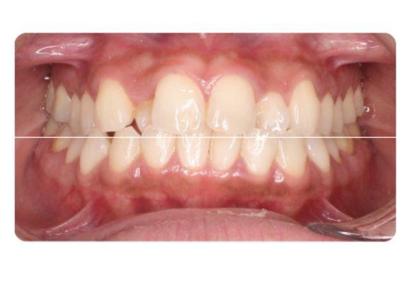 Markham Orthodontics