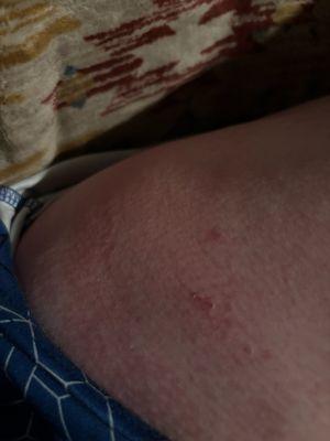 Premier Prosthetics and Orthotics