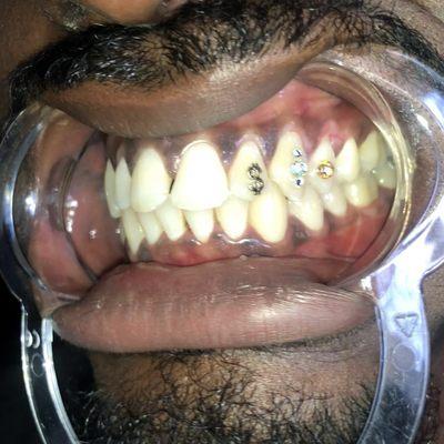 18k gold tooth charm & custom Swarovski crystal design