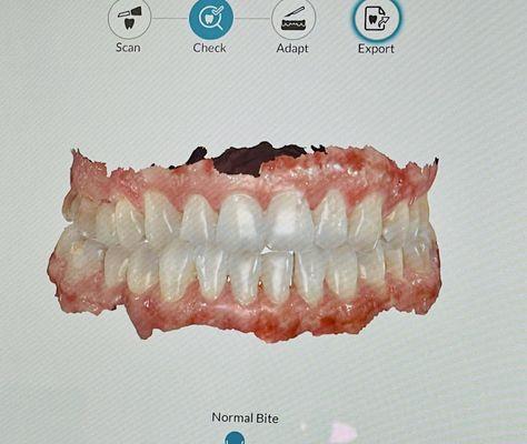 3D Imaging of my TEETH!