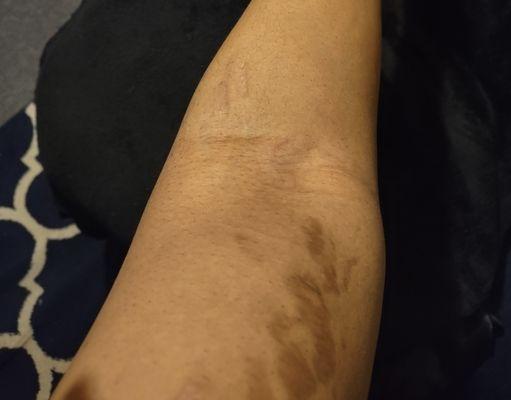 BioLife Plasma Services