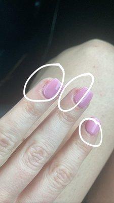 Wrecked my cuticles