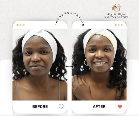 4Ever Glow Salon & MedSpa