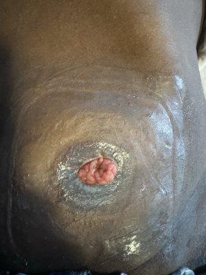 Unison Health Services