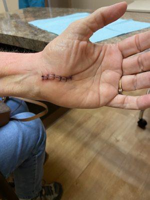 Arizona Center for Hand to Shoulder Surgery