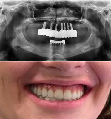 Sunshine Lab Torrance