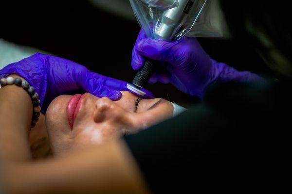 Microchanneling helps most skins conditions. More information in our website https://bettina.beauty