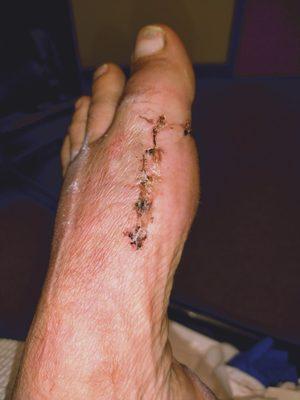 Dennis B McBroom, DPM